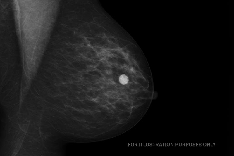 Latvijas Universitāte un Austrumu slimnīca apvieno spēkus vēža diagnostikas attīstībai Eiropā